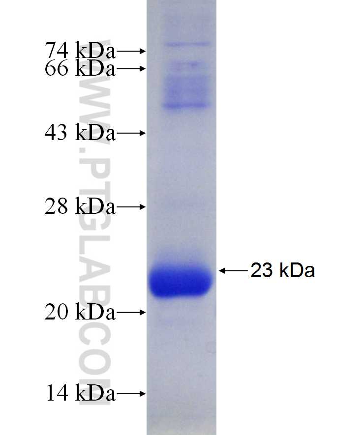 RHOT2 fusion protein Ag29690 SDS-PAGE