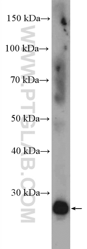 Western Blot (WB) analysis of rat lung tissue using RHOV Polyclonal antibody (26620-1-AP)