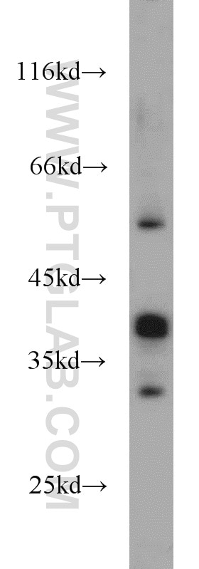 Western Blot (WB) analysis of K-562 cells using RHOXF2 Polyclonal antibody (13088-1-AP)