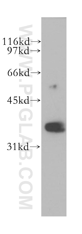 Western Blot (WB) analysis of K-562 cells using RHOXF2 Polyclonal antibody (13088-1-AP)