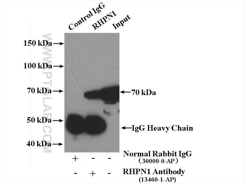 Immunoprecipitation (IP) experiment of Jurkat cells using RHPN1 Polyclonal antibody (13460-1-AP)