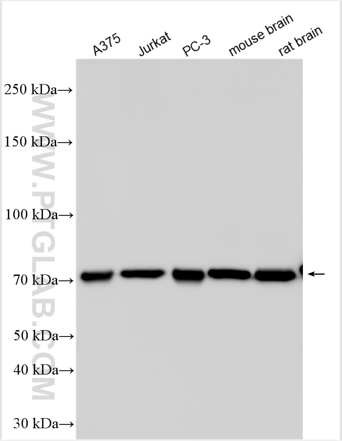 Western Blot (WB) analysis of various lysates using RHPN1 Polyclonal antibody (13460-1-AP)