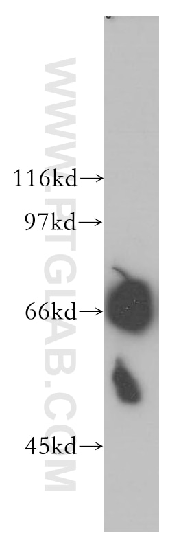 RHPN1