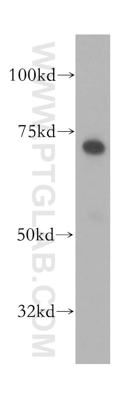 Western Blot (WB) analysis of human brain tissue using RHPN1 Polyclonal antibody (13460-1-AP)