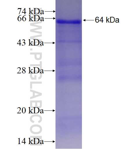 RHPN1 fusion protein Ag3933 SDS-PAGE