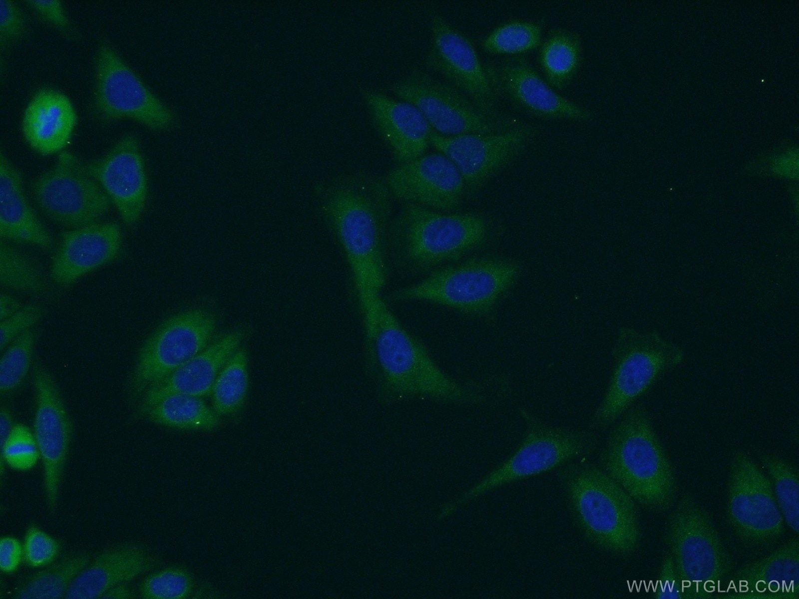 Immunofluorescence (IF) / fluorescent staining of HepG2 cells using RHPN2 Polyclonal antibody (12671-1-AP)
