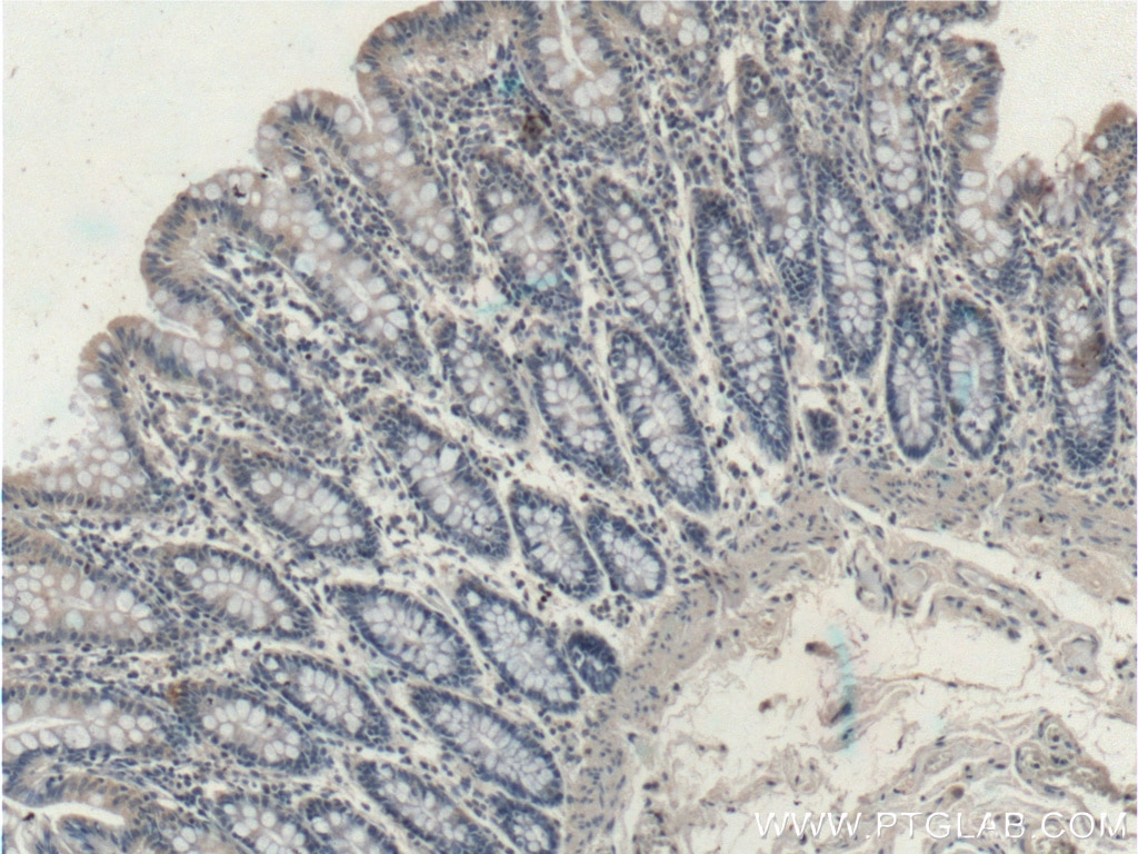 Immunohistochemistry (IHC) staining of human colon tissue using RHPN2 Polyclonal antibody (12671-1-AP)