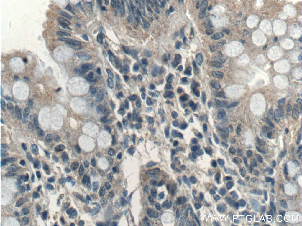 Immunohistochemistry (IHC) staining of human colon tissue using RHPN2 Polyclonal antibody (12671-1-AP)