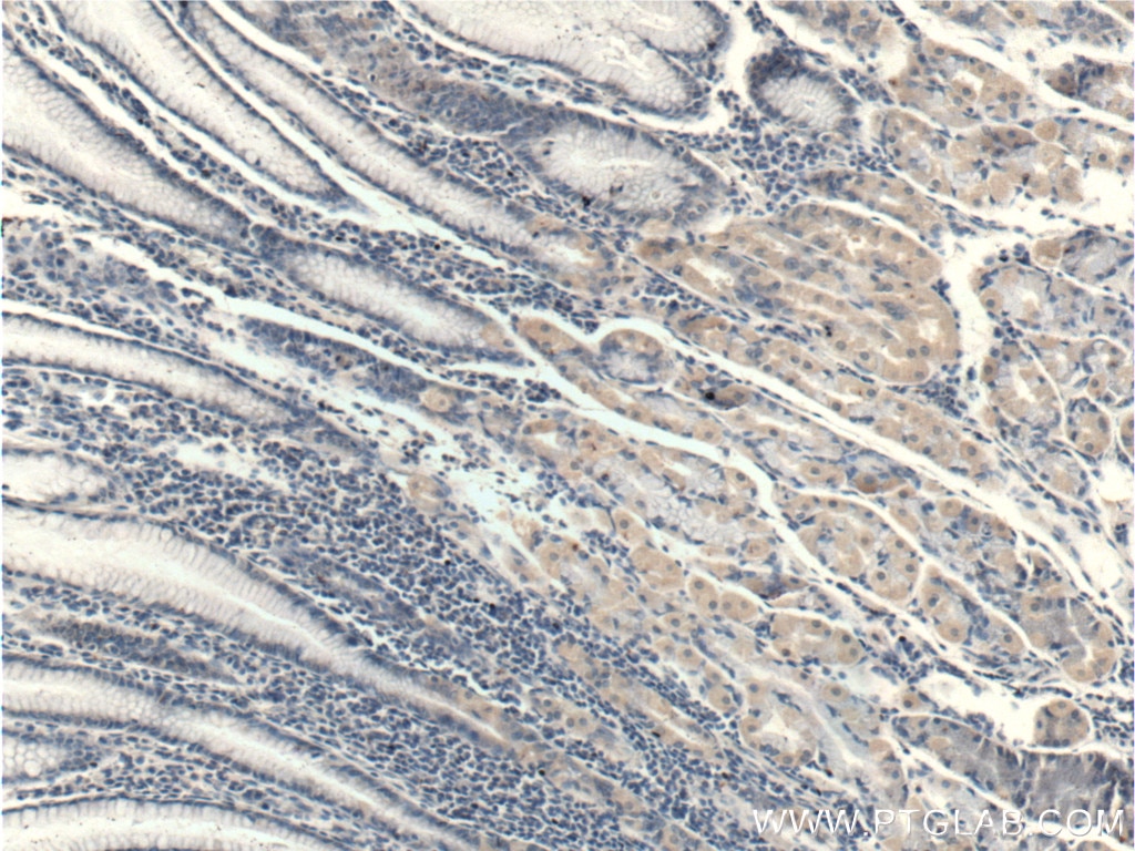 Immunohistochemistry (IHC) staining of human stomach tissue using RHPN2 Polyclonal antibody (12671-1-AP)