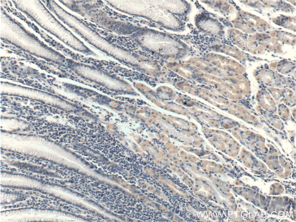 IHC staining of human stomach using 12671-1-AP