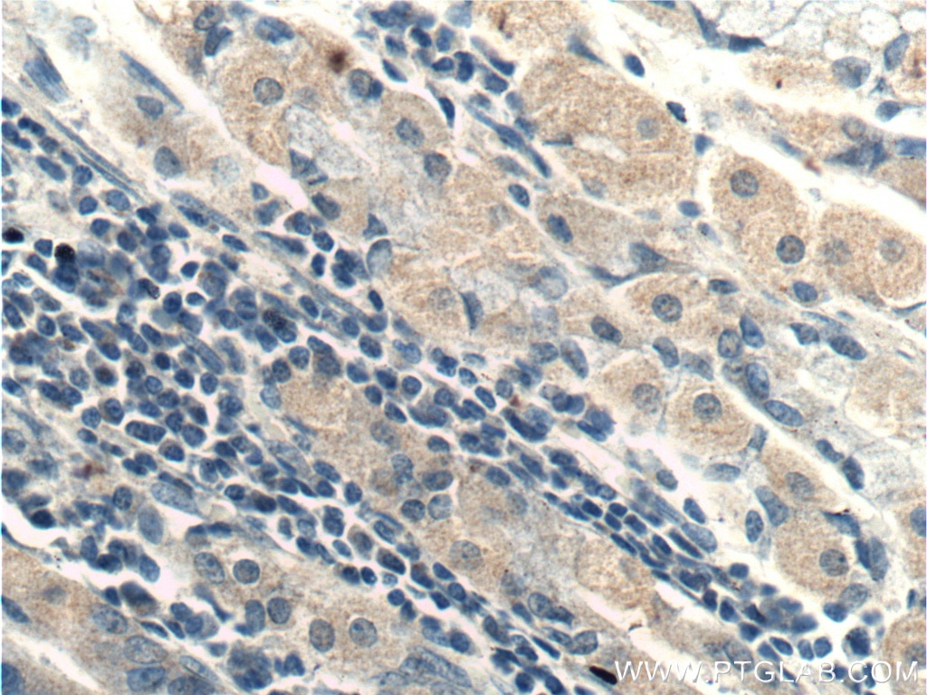Immunohistochemistry (IHC) staining of human stomach tissue using RHPN2 Polyclonal antibody (12671-1-AP)