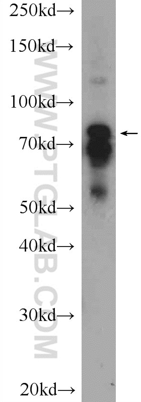 Western Blot (WB) analysis of COLO 320 cells using RHPN2 Polyclonal antibody (12671-1-AP)