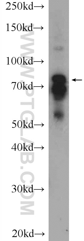 WB analysis of COLO 320 using 12671-1-AP