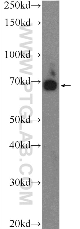 Western Blot (WB) analysis of HepG2 cells using RHPN2 Polyclonal antibody (12671-1-AP)
