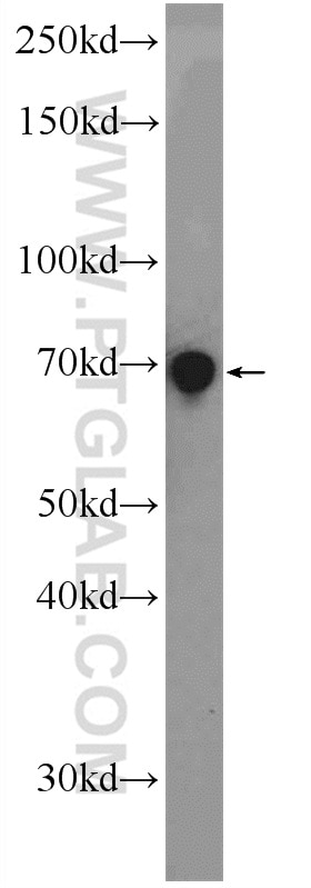 Western Blot (WB) analysis of COLO 320 cells using RHPN2 Polyclonal antibody (12671-1-AP)