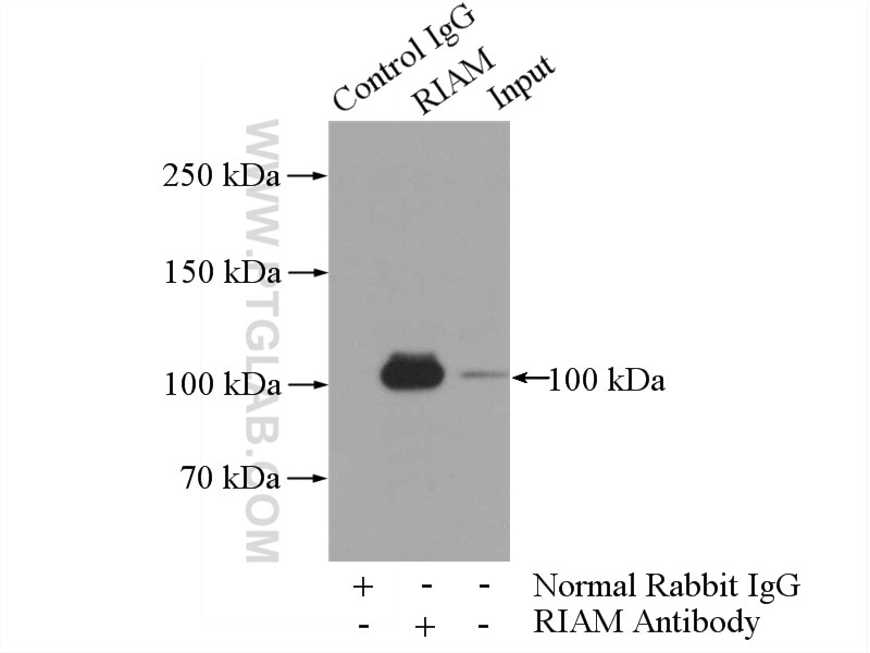 Immunoprecipitation (IP) experiment of Jurkat cells using RIAM Polyclonal antibody (13500-1-AP)