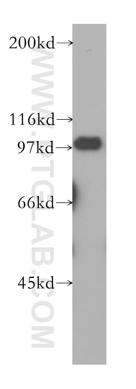 RIAM Polyclonal antibody