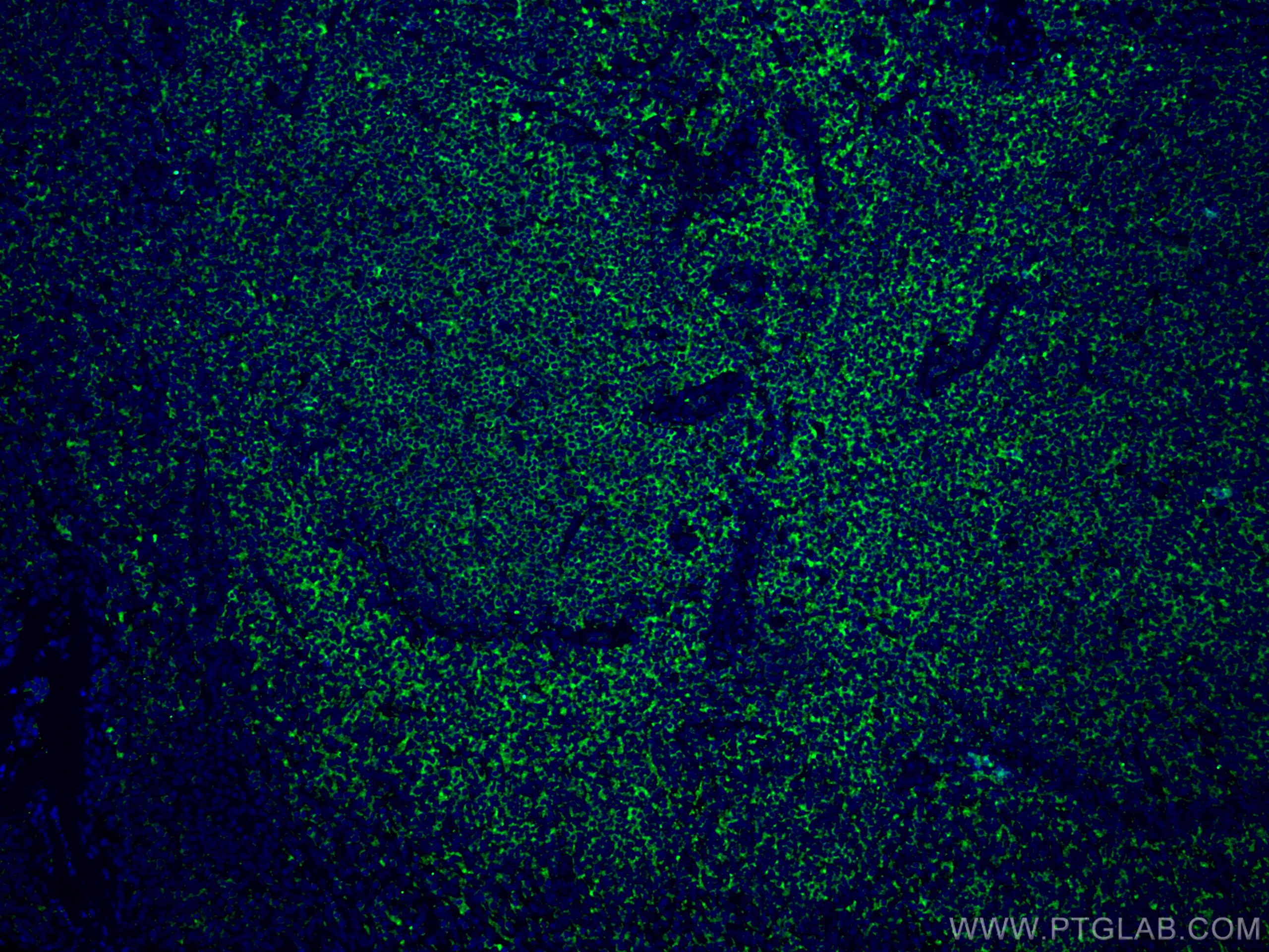 Immunofluorescence (IF) / fluorescent staining of human tonsillitis tissue using RIAM Monoclonal antibody (67143-1-Ig)