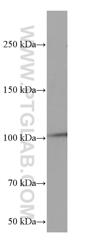 Western Blot (WB) analysis of mouse brain tissue using RIAM Monoclonal antibody (67143-1-Ig)