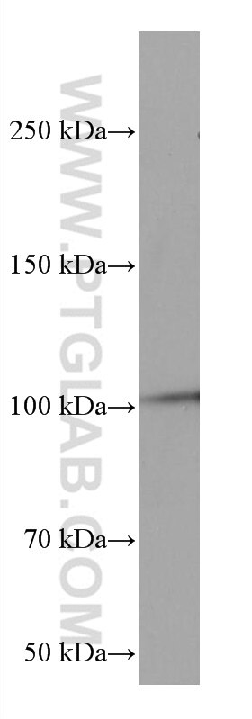 Western Blot (WB) analysis of mouse brain tissue using RIAM Monoclonal antibody (67143-1-Ig)