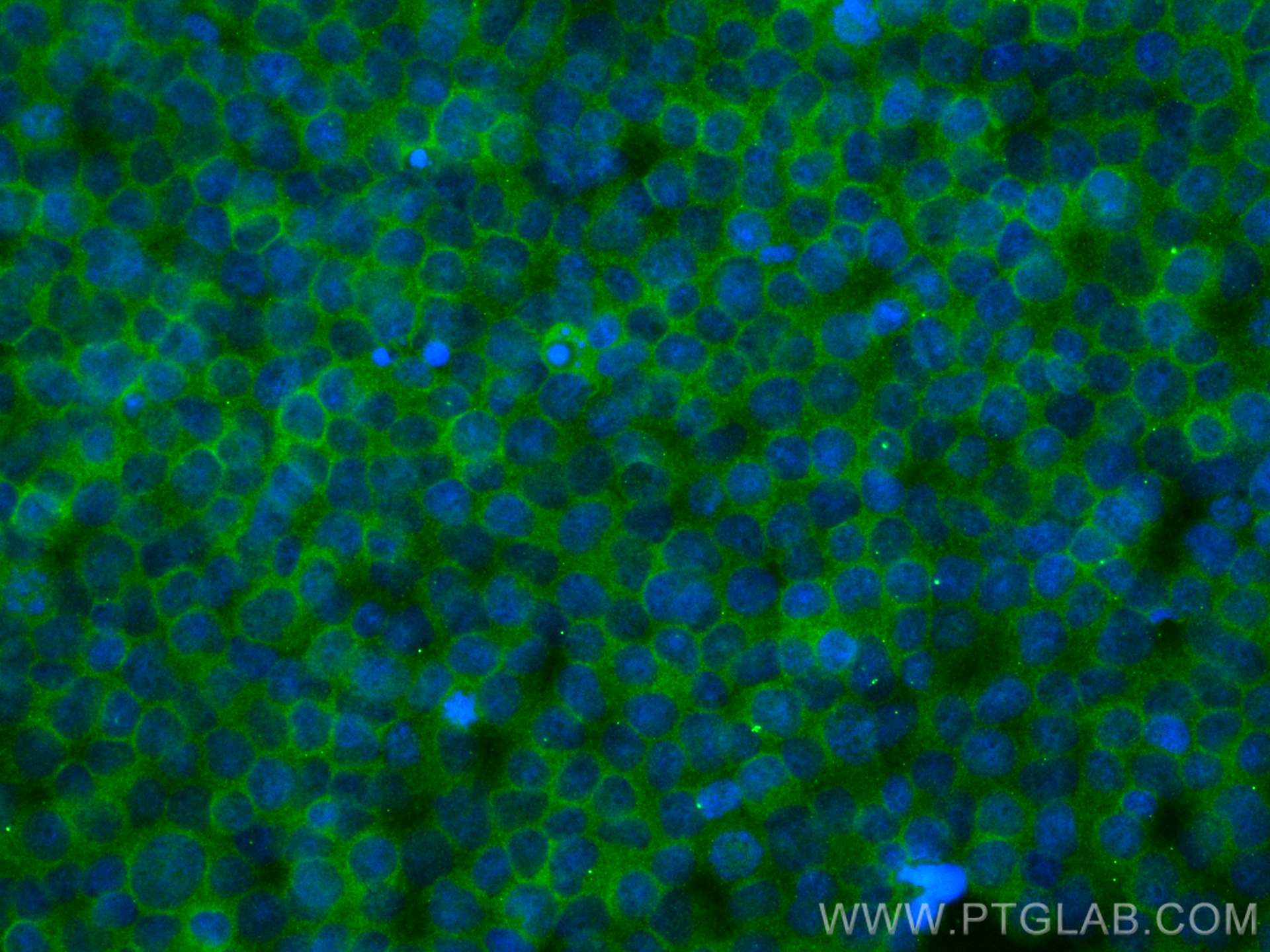 Immunofluorescence (IF) / fluorescent staining of Jurkat cells using CoraLite® Plus 488-conjugated RIAM,APBB1IP Monoclo (CL488-67143)