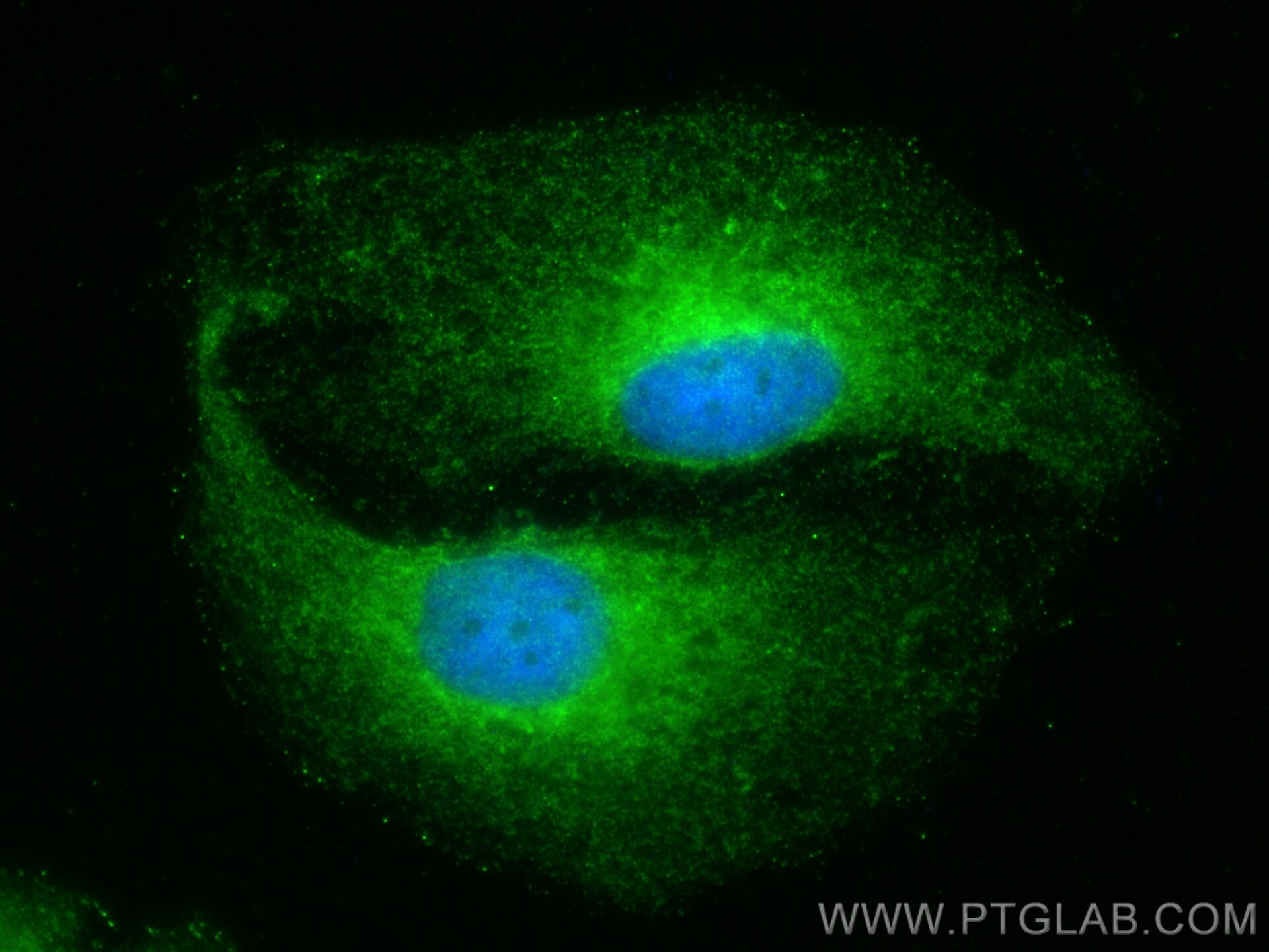 Immunofluorescence (IF) / fluorescent staining of HeLa cells using RIBC2 Polyclonal antibody (15272-1-AP)
