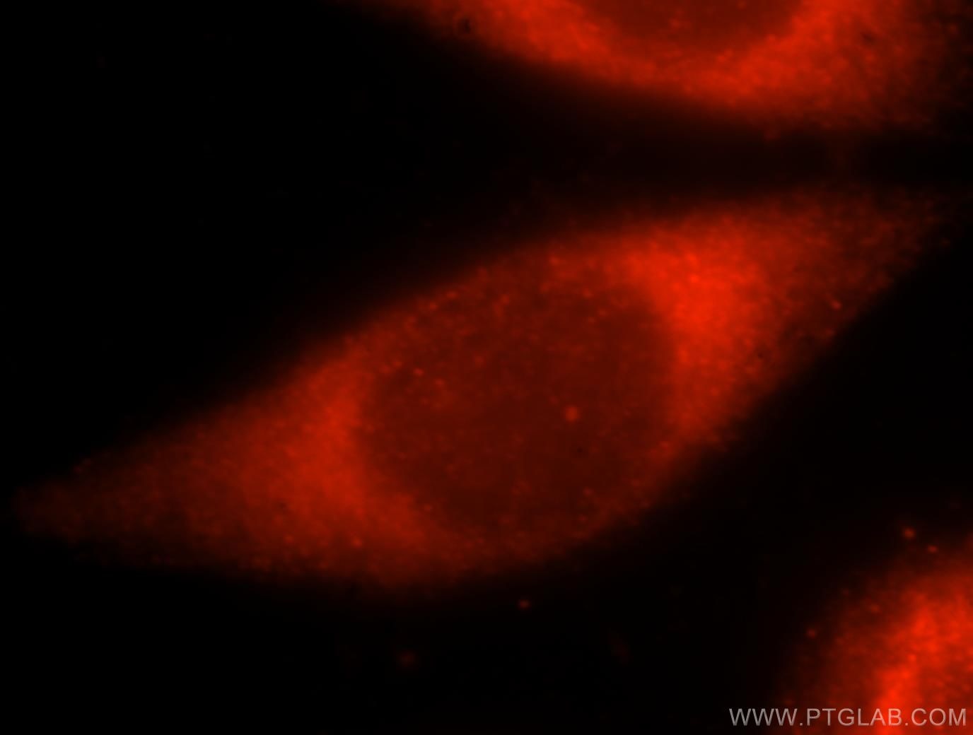 Immunofluorescence (IF) / fluorescent staining of HeLa cells using RIBC2 Polyclonal antibody (15272-1-AP)