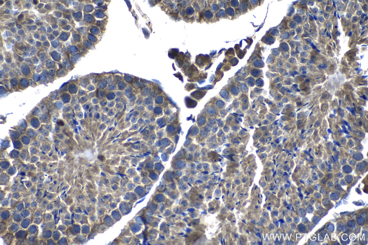 Immunohistochemistry (IHC) staining of mouse testis tissue using RIBC2 Polyclonal antibody (15272-1-AP)