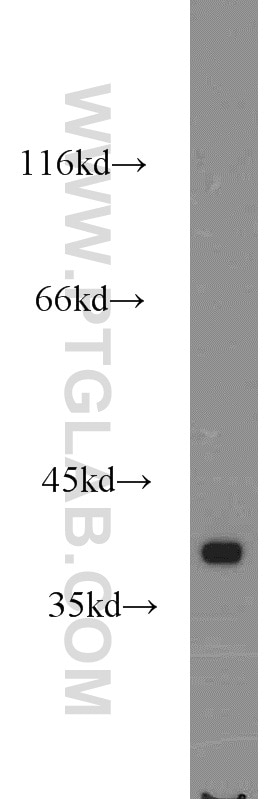 Western Blot (WB) analysis of human brain tissue using RIBC2 Polyclonal antibody (15272-1-AP)