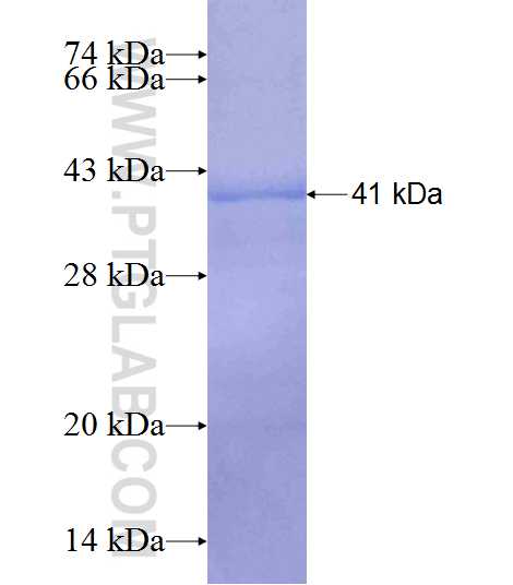 RIBC2 fusion protein Ag7820 SDS-PAGE