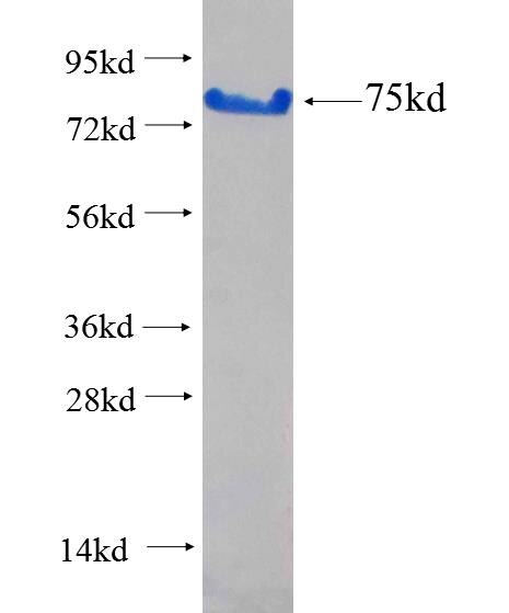 RIC3 fusion protein Ag26740 SDS-PAGE