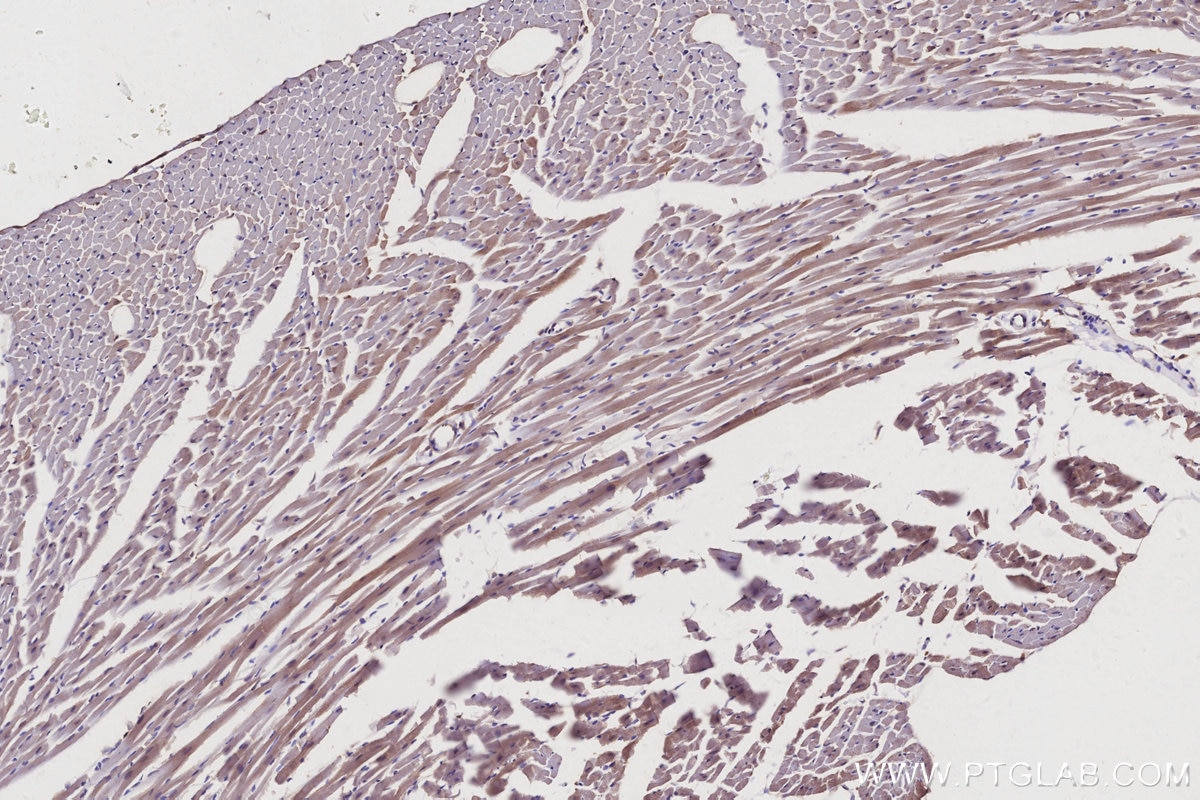 Immunohistochemistry (IHC) staining of mouse heart tissue using RIC8A Polyclonal antibody (11138-1-AP)