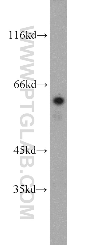Western Blot (WB) analysis of human brain tissue using RIC8A Polyclonal antibody (11138-1-AP)