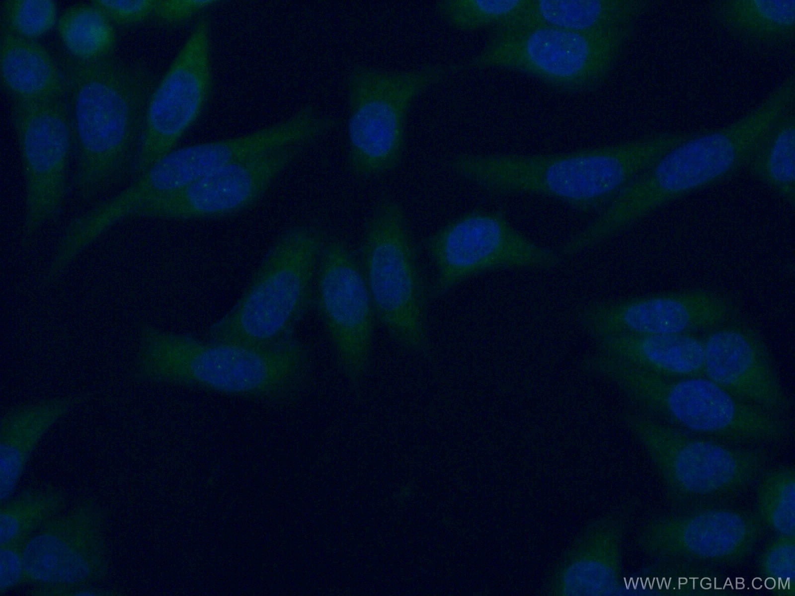 Immunofluorescence (IF) / fluorescent staining of HeLa cells using RIC8A Polyclonal antibody (18707-1-AP)