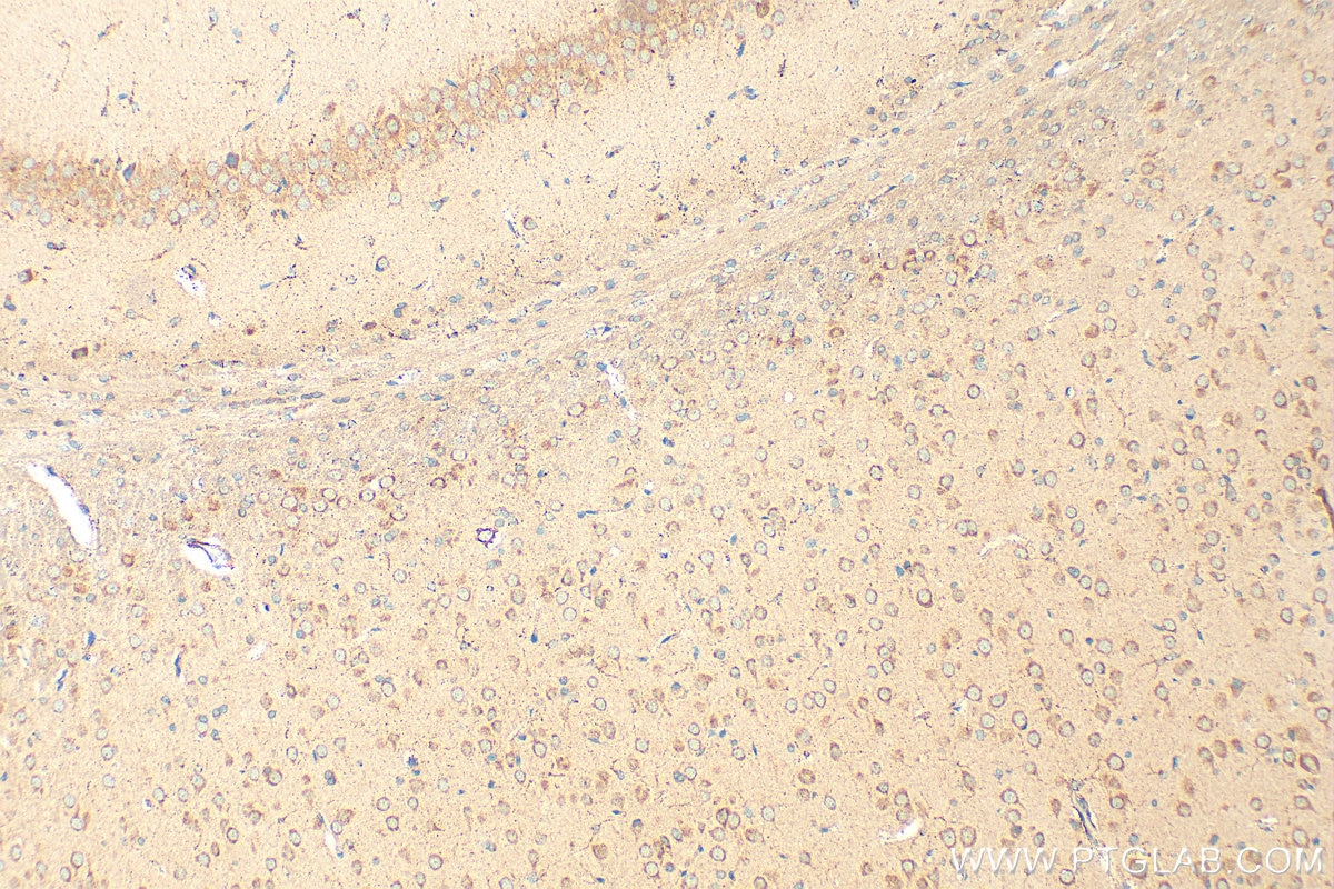 Immunohistochemistry (IHC) staining of rat brain tissue using RIC8A Polyclonal antibody (18707-1-AP)