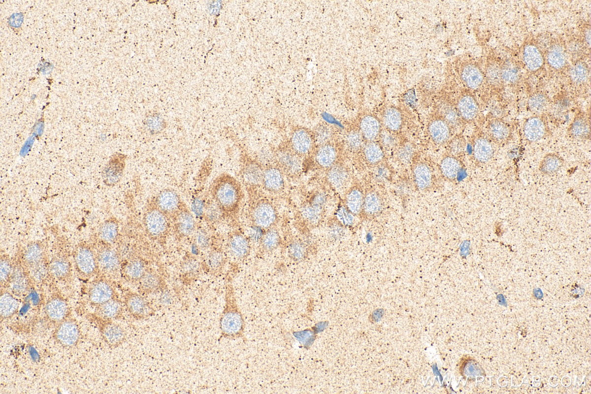 Immunohistochemistry (IHC) staining of rat brain tissue using RIC8A Polyclonal antibody (18707-1-AP)