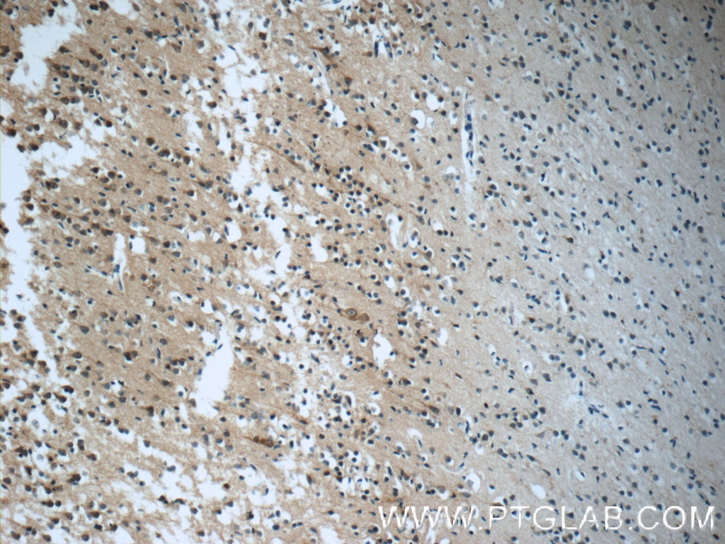 Immunohistochemistry (IHC) staining of human brain tissue using RIC8A Polyclonal antibody (18707-1-AP)