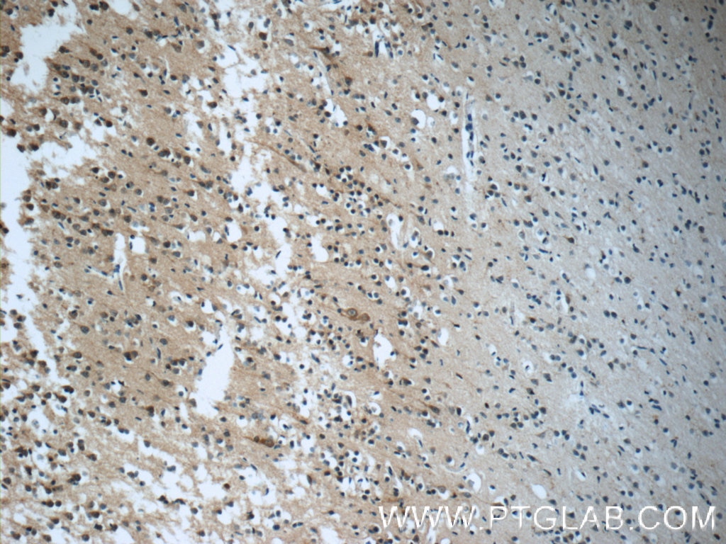 Immunohistochemistry (IHC) staining of human brain tissue using RIC8A Polyclonal antibody (18707-1-AP)