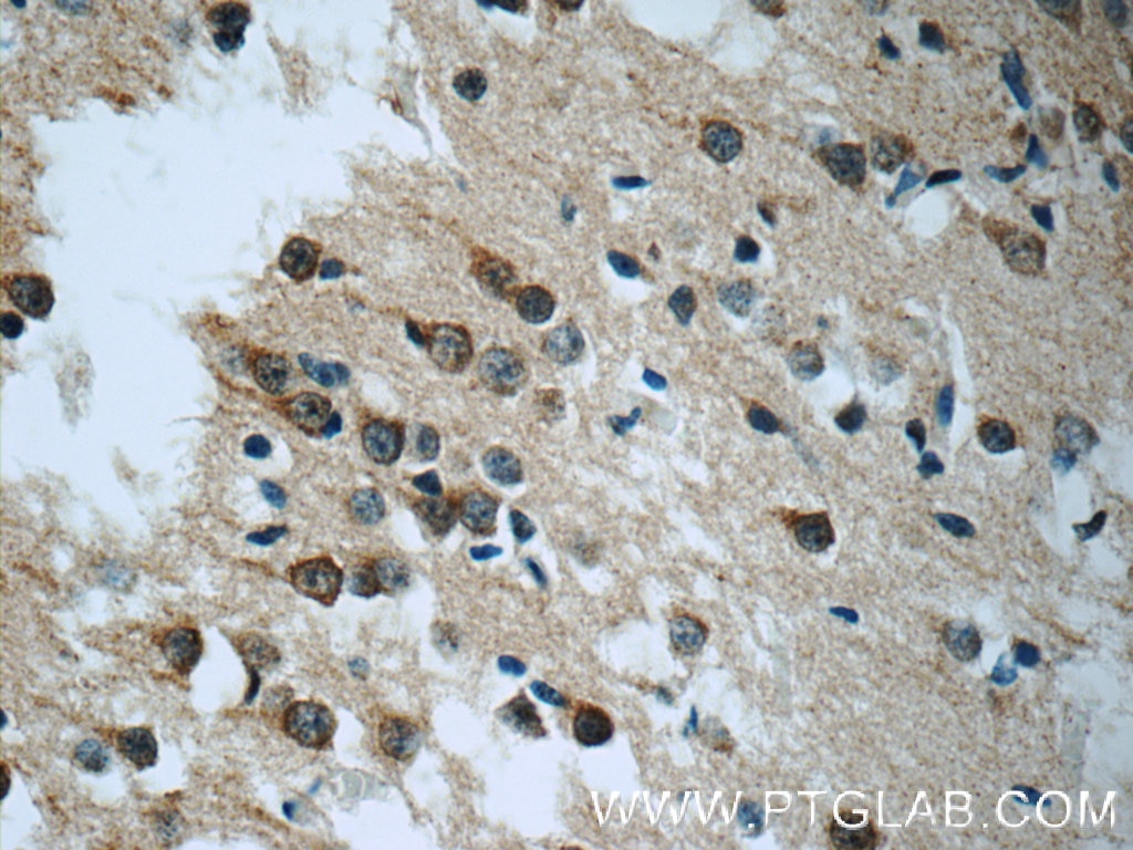 Immunohistochemistry (IHC) staining of human brain tissue using RIC8A Polyclonal antibody (18707-1-AP)