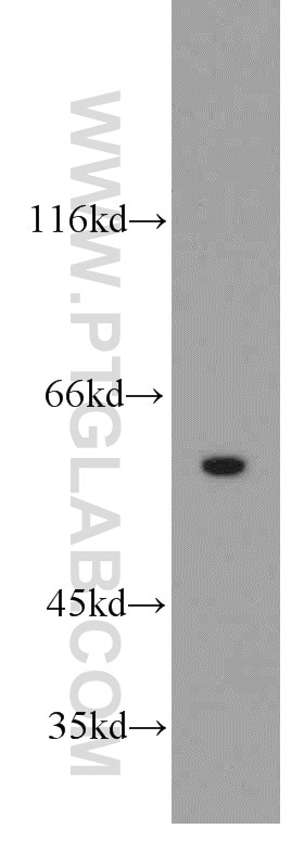 Western Blot (WB) analysis of human brain tissue using RIC8A Polyclonal antibody (18707-1-AP)