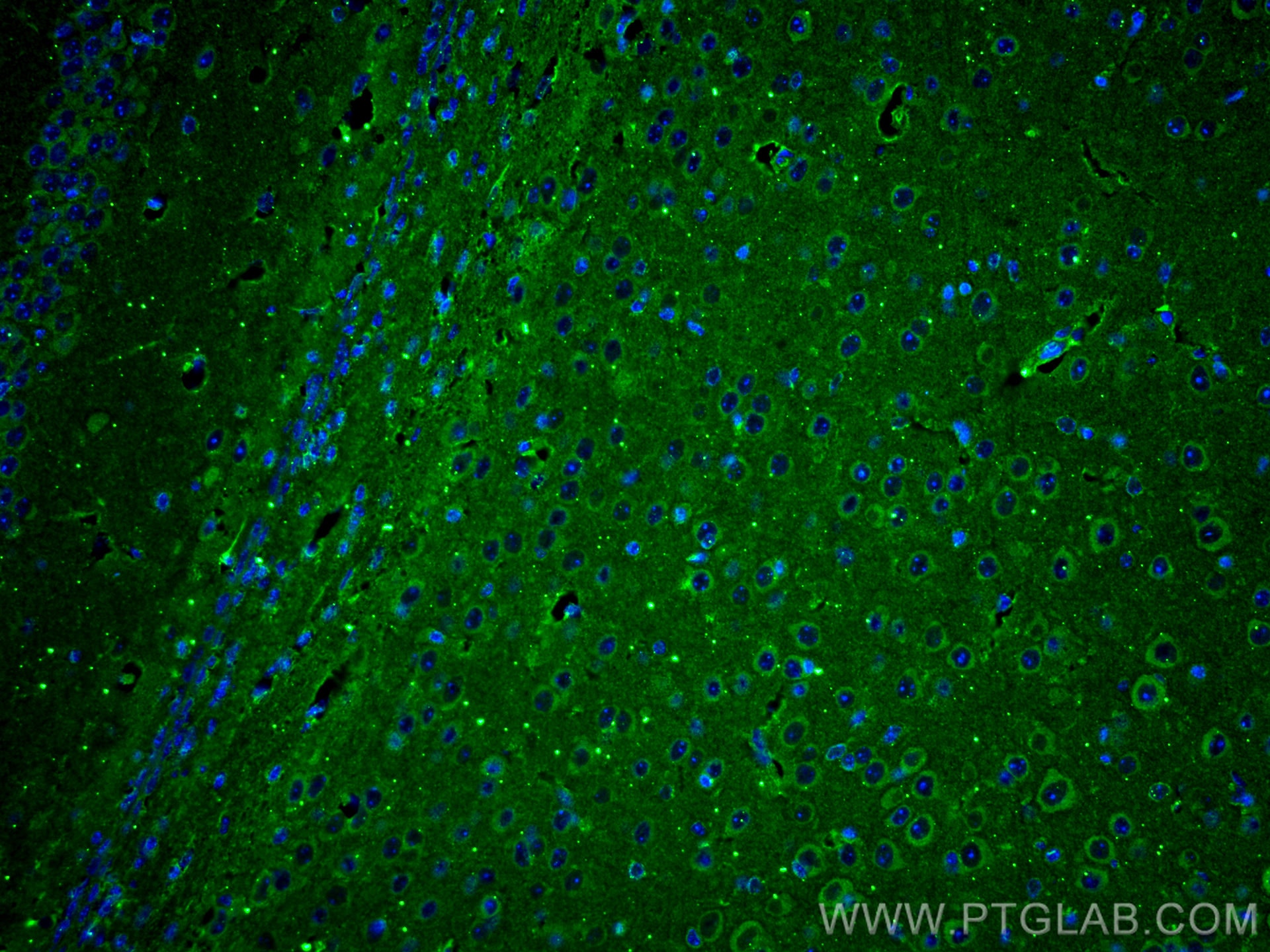 Immunofluorescence (IF) / fluorescent staining of mouse brain tissue using RIC8A Monoclonal antibody (66625-1-Ig)