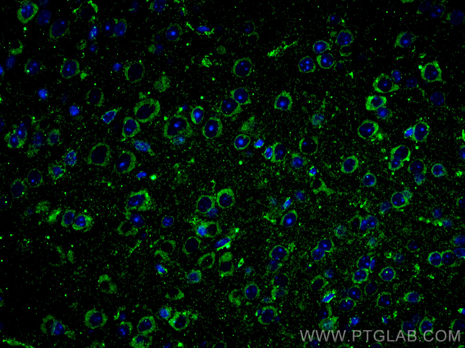 IF Staining of mouse brain using 66625-1-Ig