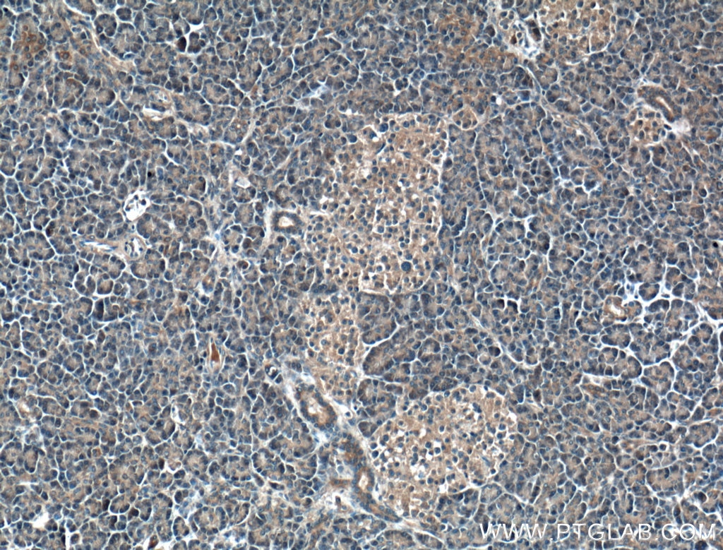 Immunohistochemistry (IHC) staining of human pancreas tissue using RIC8A Monoclonal antibody (66625-1-Ig)