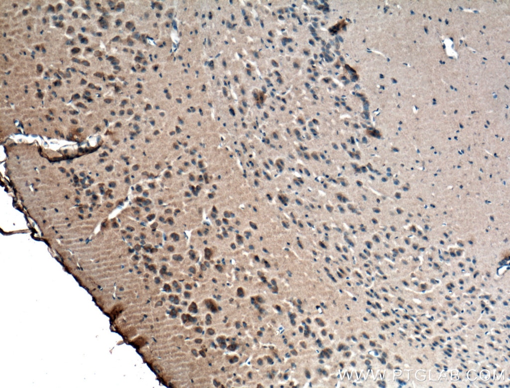 Immunohistochemistry (IHC) staining of mouse brain tissue using RIC8A Monoclonal antibody (66625-1-Ig)