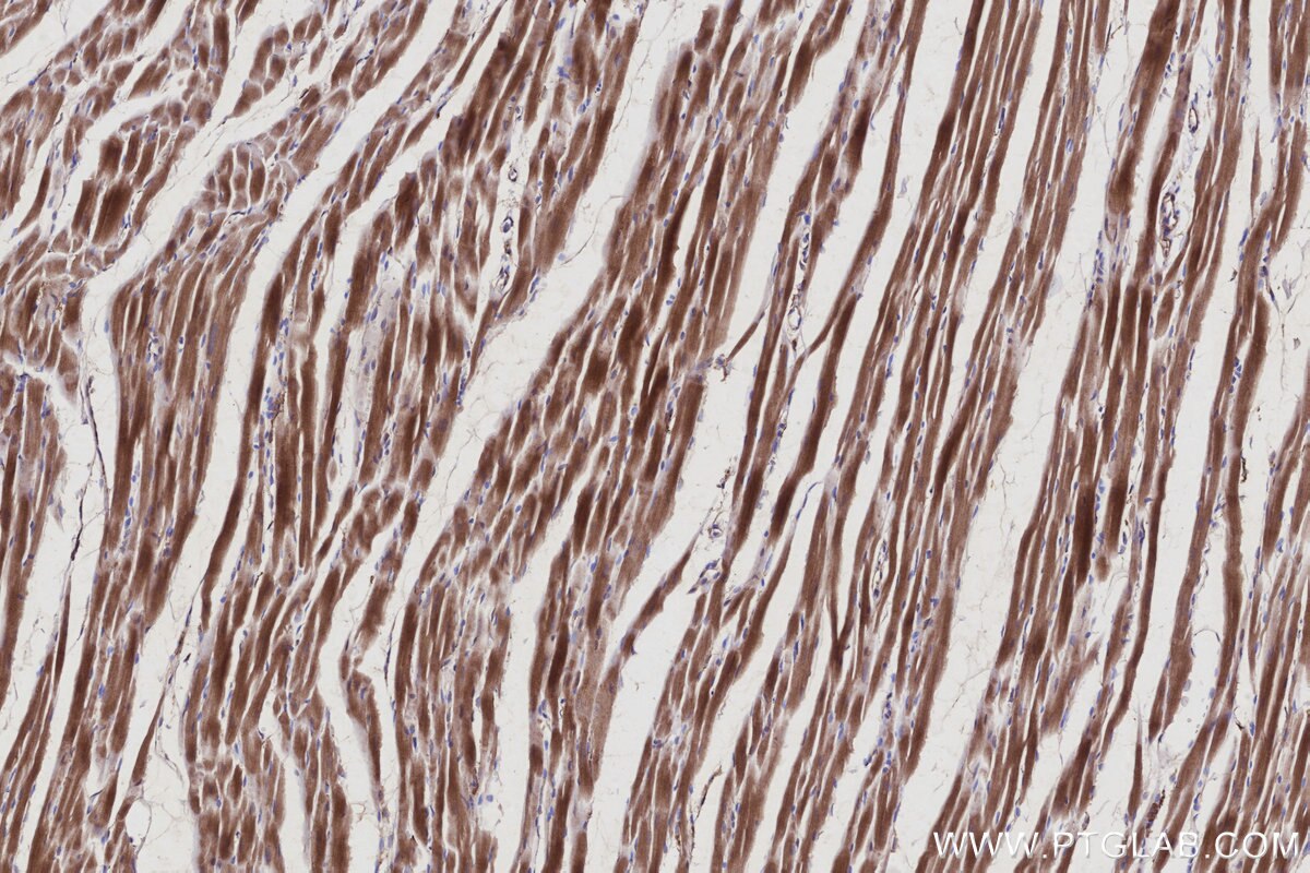 IHC staining of rat heart using 66625-1-Ig Immunohistochemistry (IHC) staining of rat heart tissue using RIC8A Monoclonal antibody (66625-1-Ig)