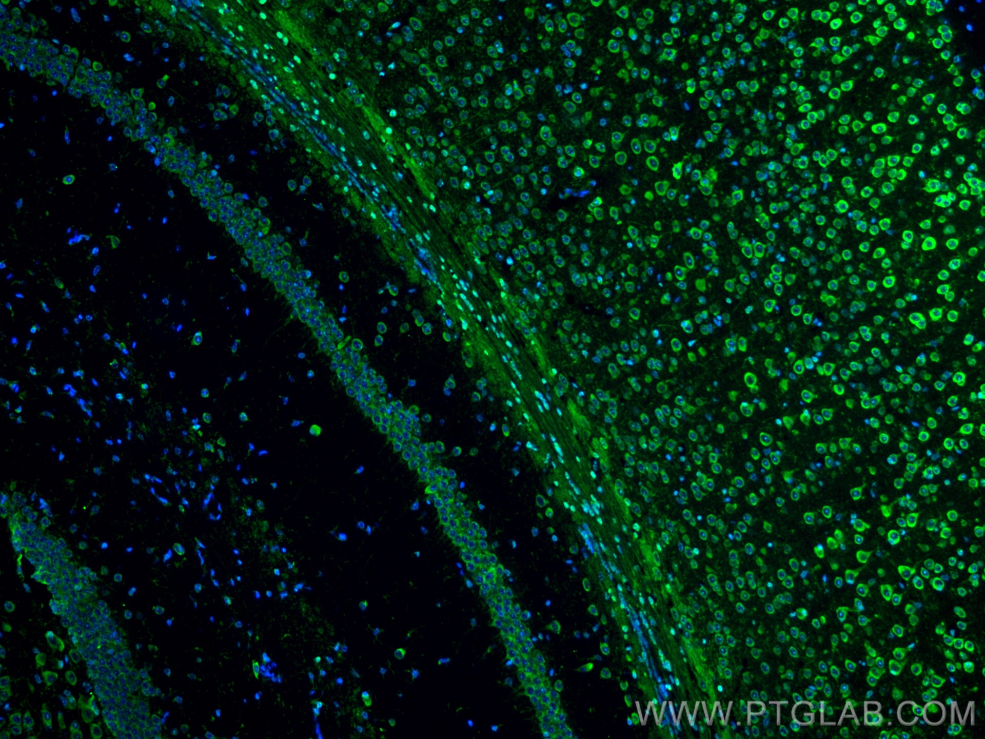 IF Staining of mouse brain using CL488-66625