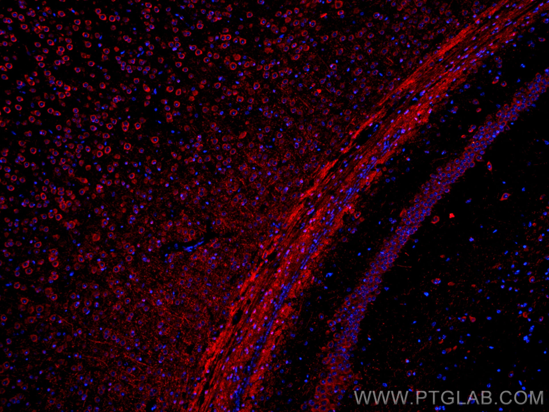 IF Staining of mouse brain using CL594-66625