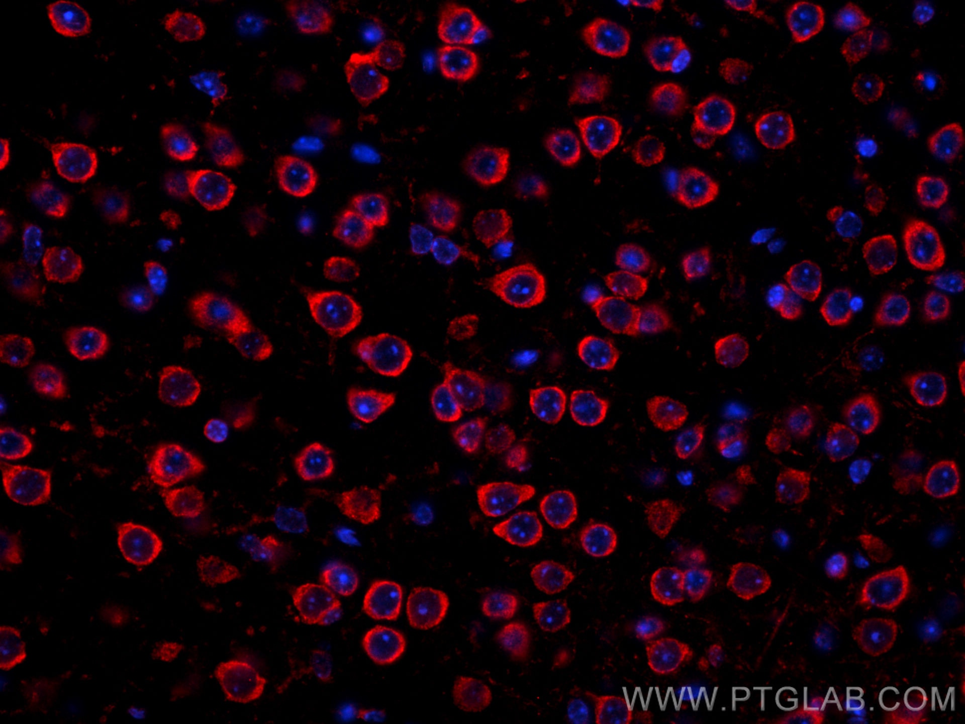 Immunofluorescence (IF) / fluorescent staining of mouse brain tissue using CoraLite®594-conjugated RIC8A Monoclonal antibody (CL594-66625)