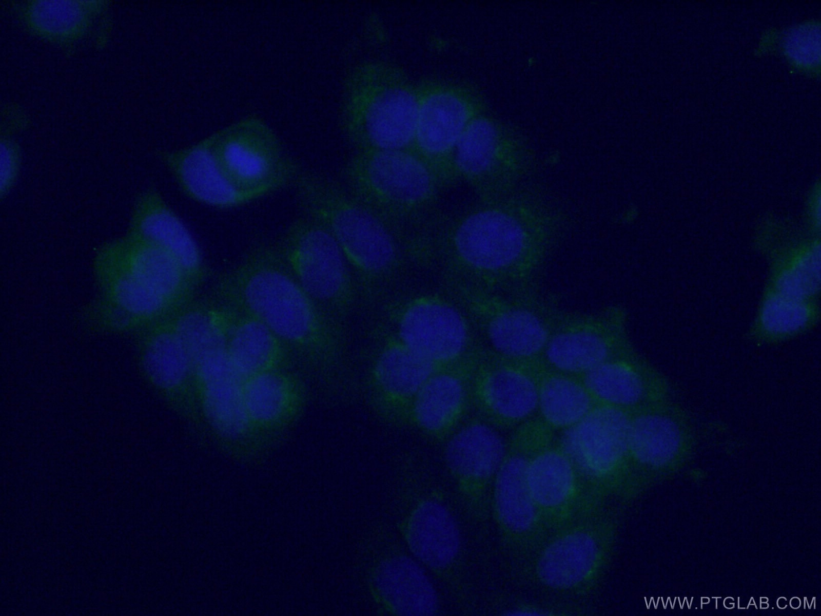 Immunofluorescence (IF) / fluorescent staining of MCF-7 cells using RIC8B Polyclonal antibody (17790-1-AP)