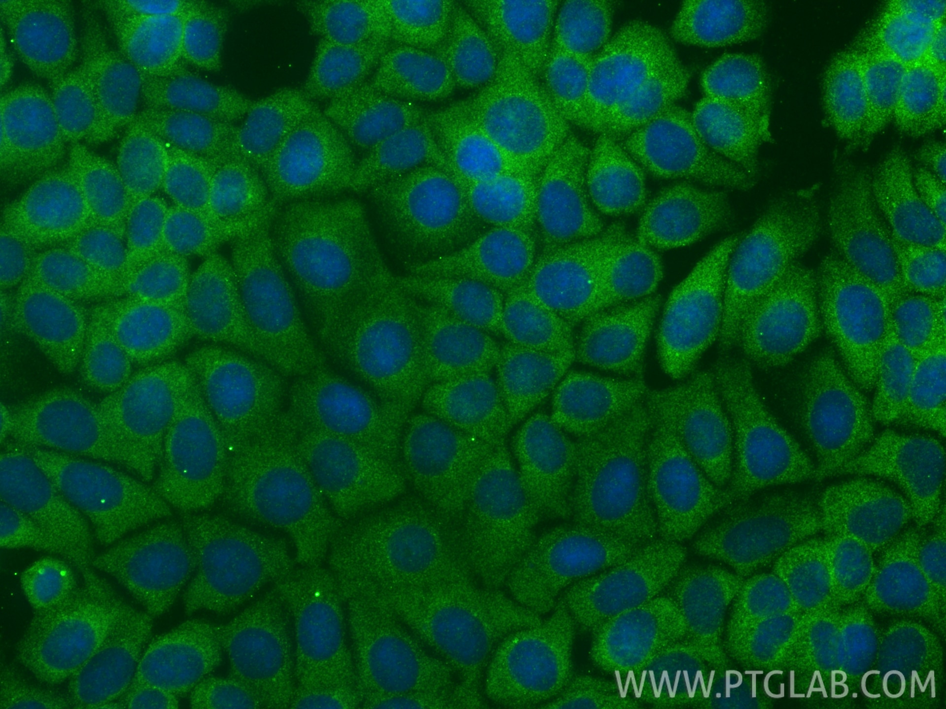 Immunofluorescent analysis of (-20°C Methanol) fixed MCF-7 cells using RIC8B antibody (17790-1-AP) at dilution of 1:400 and CoraLite®488-Conjugated Goat Anti-Rabbit IgG(H+L) (SA00013-2). Immunofluorescence (IF) / fluorescent staining of MCF-7 cells using RIC8B Polyclonal antibody (17790-1-AP)